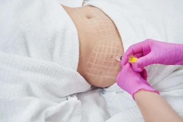 image of fat dissolving injections on love handles to help combat weight gain West End